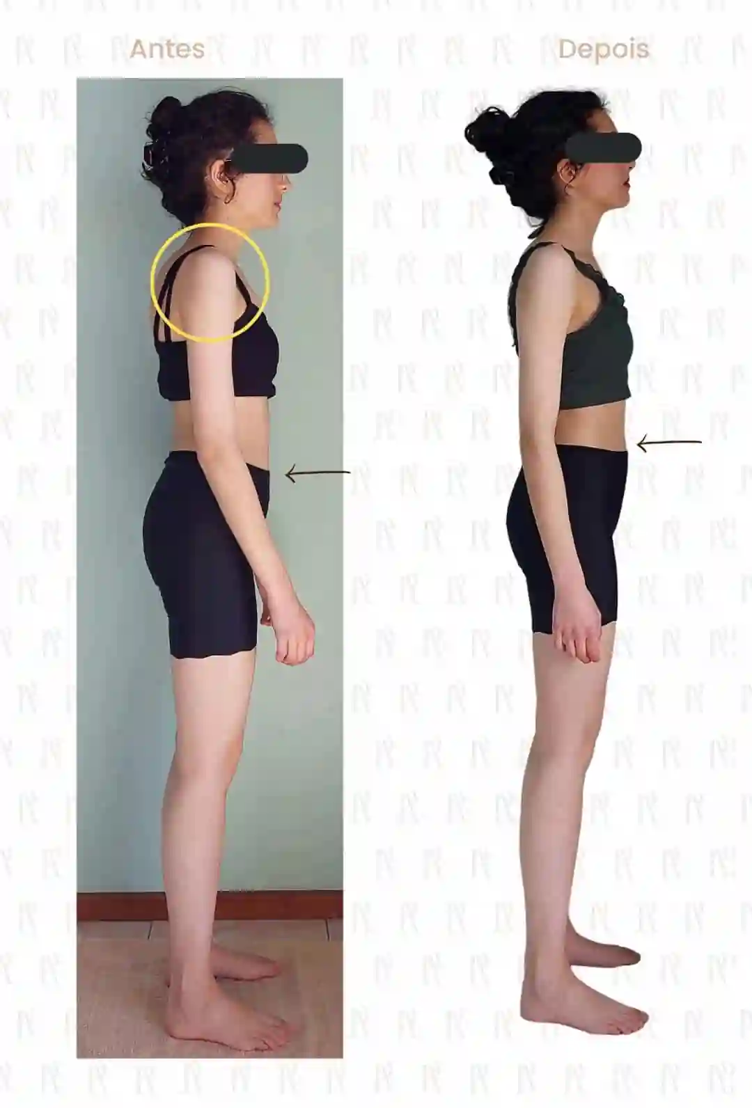 Antes e Depois 9